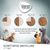 Schéma de transition alimentaire sur 11 jours pour chats et chiens, texte en allemand, logo Concept for Life, bols montrant la proportion croissante du nouvel aliment à chaque étape.