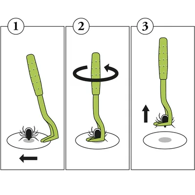 Instruktion för borttagning av fästing: 1. Skjut fästingpincetten under fästingen, 2. Vrid pincetten, 3. Dra ut fästingen.