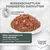 Wissenschaftlich fundiertes Diätfutter, getreidefreie Rezeptur. Beste Akzeptanz und Verträglichkeit durch hochwertige Fleischrohwaren. Concept for Life Logo sichtbar.