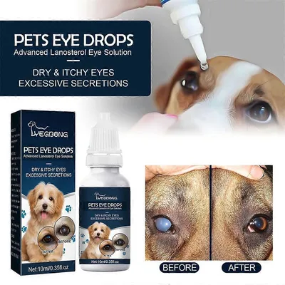 MCBOSON Gouttes pour les yeux