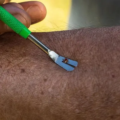 IntiMeg Kit anti - puces et tiques en acier inoxydable