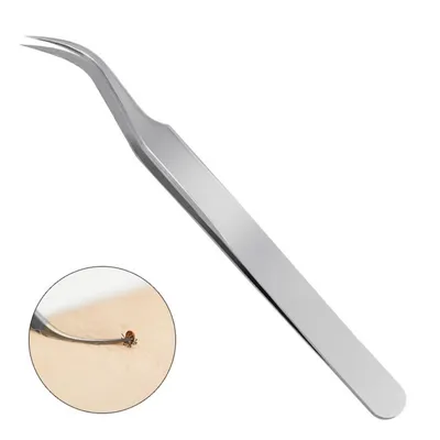 IntiMeg Ensemble de pinces anti-tiques en inox