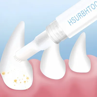 FurryFusion Stylo brosse à dents pour animaux