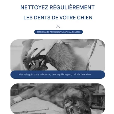 IntiMeg Brosse à dents à ultrasons pour nettoyer le tartre dentaire