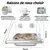 ZooVenture Transparent Mangeoire Pour Oiseaux