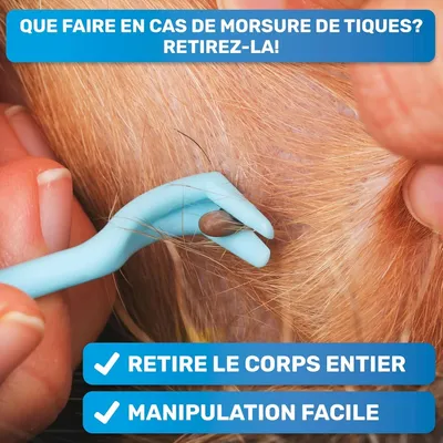 MCBOSON Lot de 2 Pinces à Tiques 3 tailles Chiens Chats Humains (Rose) MCBOSON Lot de 2 Pinces à Tiques 3 tailles Chiens Chats Humains (Rose)