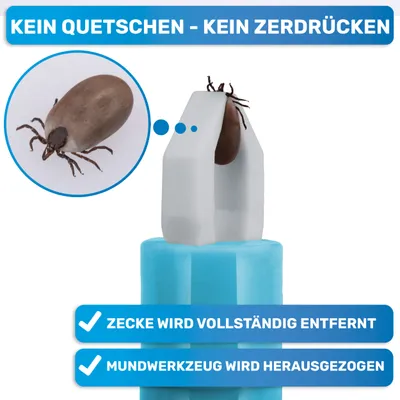 BluePet 3x Zeckenpinzette, Automatische Zeckenzange Zeckenentferner BluePet 3x Zeckenpinzette, Automatische Zeckenzange Zeckenentferner