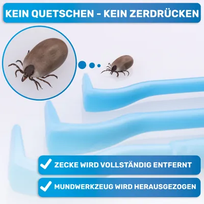 BluePet Zeckenhaken 3er Set, Zeckenentferner für Mensch & Tier, Zeckenhebel BluePet Zeckenhaken 3er Set, Zeckenentferner für Mensch & Tier, Zeckenhebel