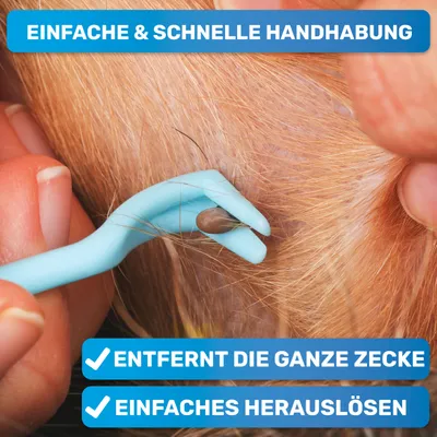 BluePet Premium Zeckenhaken 3er Set kleine Zeckenhebel Zeckenentferner BluePet Premium Zeckenhaken 3er Set kleine Zeckenhebel Zeckenentferner